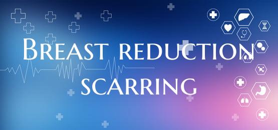 Breast reduction scarring