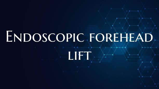 Endoscopic forehead lift