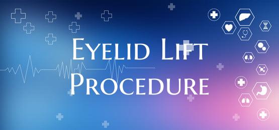 Eyelid Lift Procedure