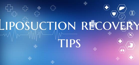 Liposuction recovery tips