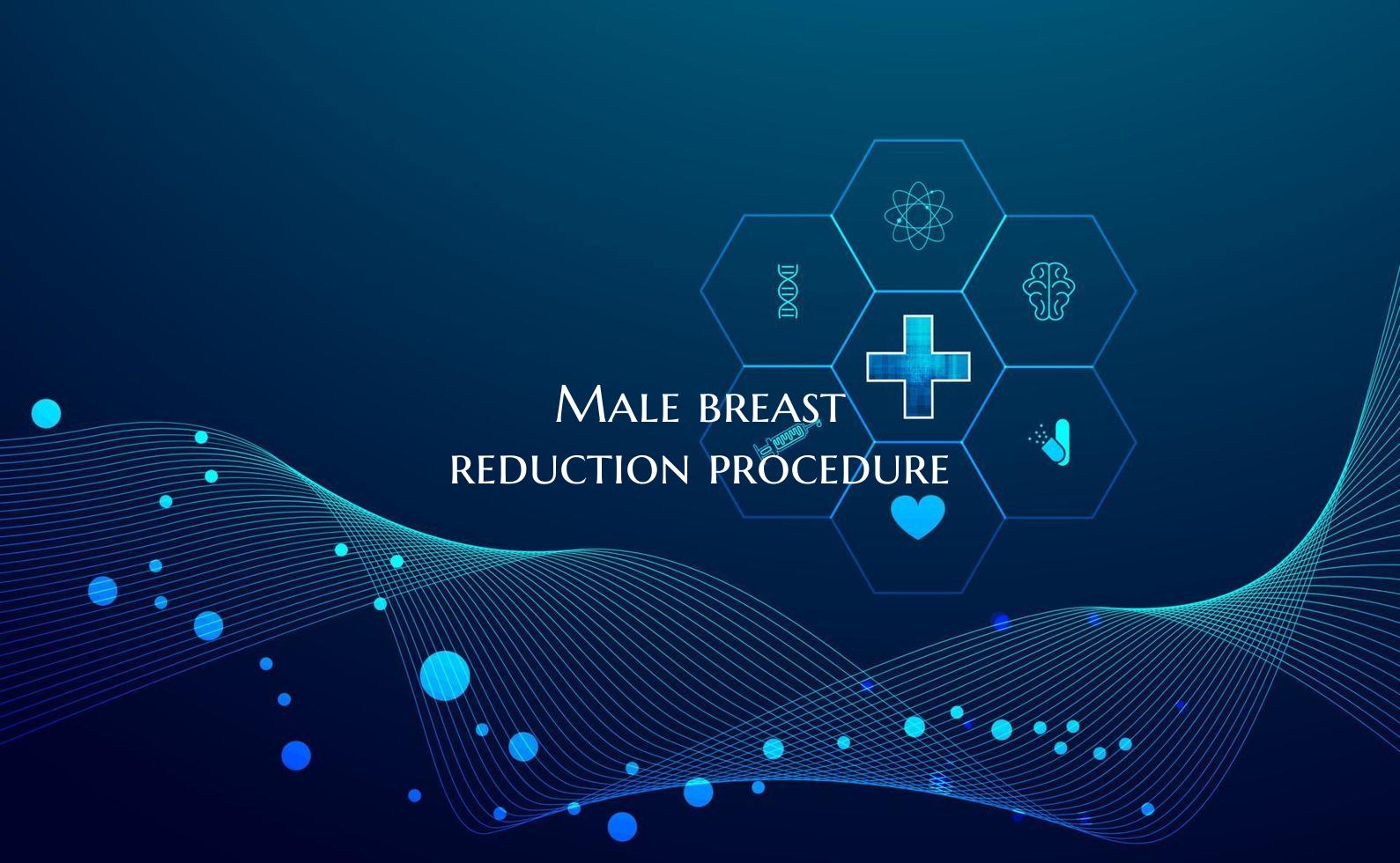 Male breast reduction procedure